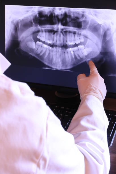 Best Emergency Broken Tooth Repair in Ellensburg, WA